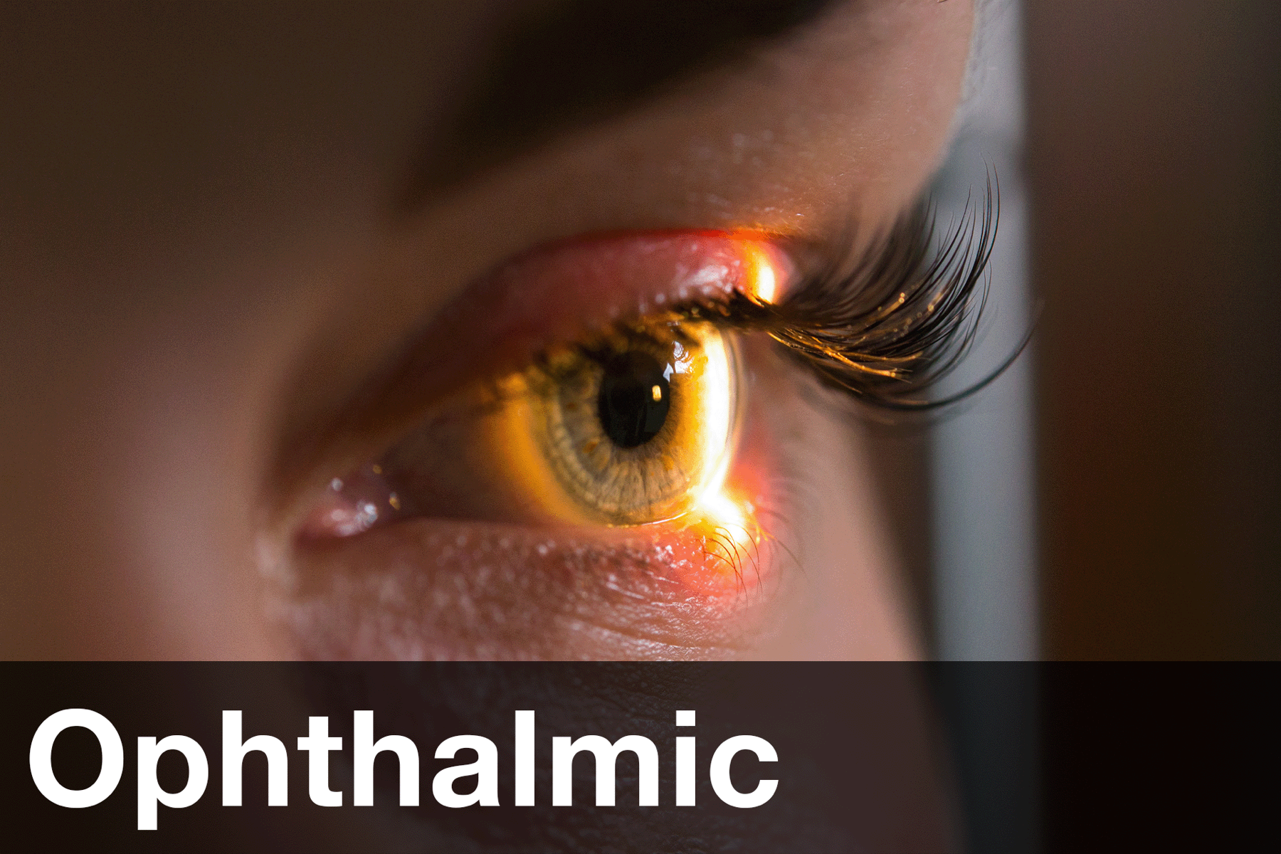 Ophthalmic